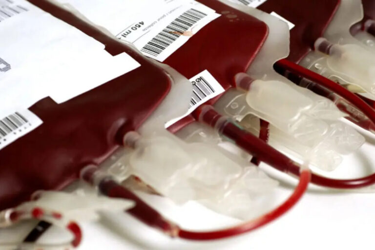 Scopri di più sull'articolo Epatite C: sì al risarcimento se l’emotrasfusione è la “probabilità prevalente”